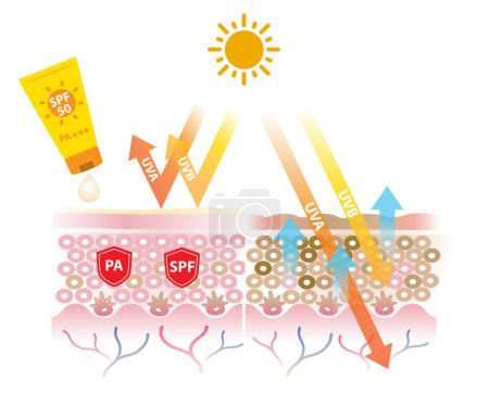Illustration for Sunscreen with PA and SPF block UVA and UVB rays vector on white background. Comparison of skin layer with sunscreen and without sunscreen. Skin care and beauty concept illustration. - Royalty Free Image