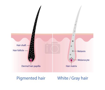 Illustration for The mechanism of pigmented hair and white/ gray hair with scalp layer vector on white background. Hair anatomy, hair structure, hair care concept illustration. - Royalty Free Image