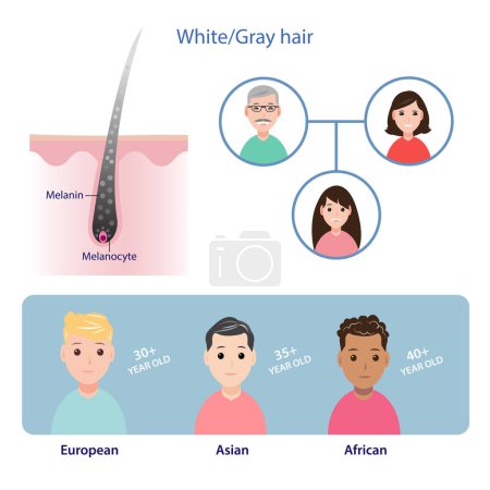 Illustration for The mechanism of hair graying with scalp layer. That can be inherited from parents. The average ages are the mid-30s for European people, late 30s for Asian people, and mid-40s for African people. Hair care concept illustration. - Royalty Free Image