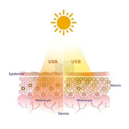 Ilustración de La radiación UVA y UVB penetran en el vector de la capa de piel sobre fondo blanco. Los rayos UVA y UVB afectan la piel de diferentes maneras. - Imagen libre de derechos