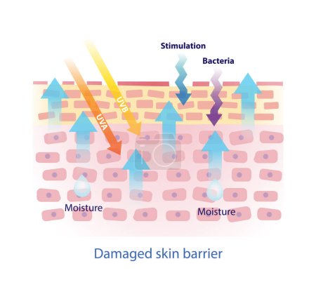 Illustration for Damaged skin barrier vector on white background. The weak skin barrier make tight arrangement between cells is lost, irritants to get in easier and dehydrated skin. Skin care and beauty concept. - Royalty Free Image