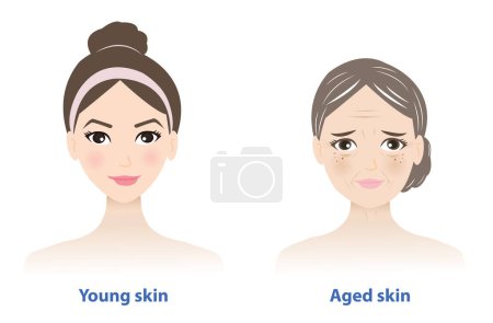 Illustration for Differences between young and aged skin. Youthful healthy skin looks smooth, tight, strong and normal collagen content. Aged skin contains several signs of degeneration. Skin care and beauty concept. - Royalty Free Image