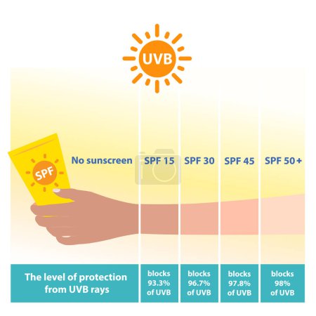 Ilustración de Los diferentes niveles de SPF 15, 30, 45 y 50 protector solar protegen los rayos UVB vector sobre fondo blanco. Comparación del tono de la piel del brazo con el nivel del protector solar del factor de protección solar. Cuidado de la piel y belleza concepto ilustración. - Imagen libre de derechos