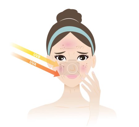 Illustration for Sun damaged skin on woman face vector illustration on white background. Premature aging, wrinkling, photoaging, photodamage, solar damage, sun damage and skin damage from sun exposure. Skin care and beauty concept. - Royalty Free Image