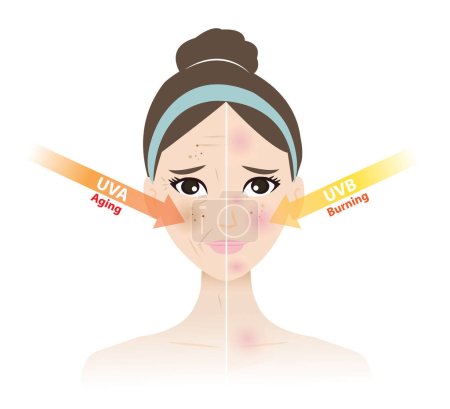 Comparaison des lésions cutanées dues aux rayons UVA et UVB sur le vecteur facial de la femme sur fond blanc. Les rayons UV pénètrent dans la peau, les rayons UVA provoquent le vieillissement de la peau, les rayons UVB provoquent des brûlures cutanées. Illustration de concept soin de la peau et beauté.