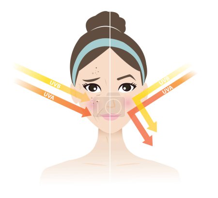 Comparison of damaged skin from UVA and UVB rays and healthy skin prevent sun damaged on woman face vector illustration on white background. Premature aging, wrinkling, photoaging, sun damage and burning from sun exposure.