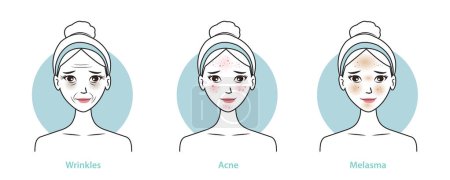 Hautprobleme setzen die Vektordarstellung isoliert auf weißem Hintergrund. Infografik der netten Frau mit Falten, Augenringen, Akne, Melasma und dunklen Flecken im Gesicht. Hautpflege und Schönheitskonzept.