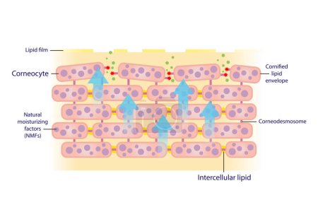 Der Mechanismus des Peelings Korneozyten, Hautzellen Vektor isoliert auf weißem Hintergrund. Corneodesmosom durch Enzyme abgebaut, Talgbarriere verringert. So gelangen Bakterien in die Haut.