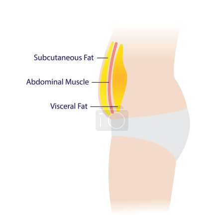 Illustration for Cross section of body fat vector illustration isolated on white background. Location of muscle, subcutaneous, visceral fat in abdominal cavity. Weight problem, fat around waistline and obesity concept. - Royalty Free Image