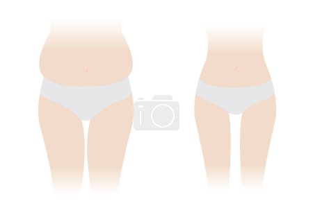 Illustration for Comparison of woman body fat and slim vector illustration isolated on white background. The woman with fat belly, hip, thigh and slender body. Slim waist compared to body fat. Before and after weight loss. - Royalty Free Image