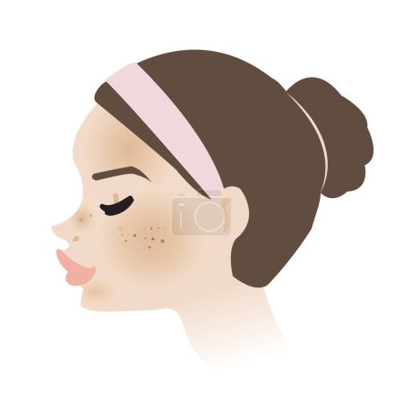 Illustration for Woman face with melasma skin side view vector isolated on white background. Hyperpigmentation, patchy dark brown and spots is on cheeks, nose, chin and forehead. Skin problem concept illustration. - Royalty Free Image