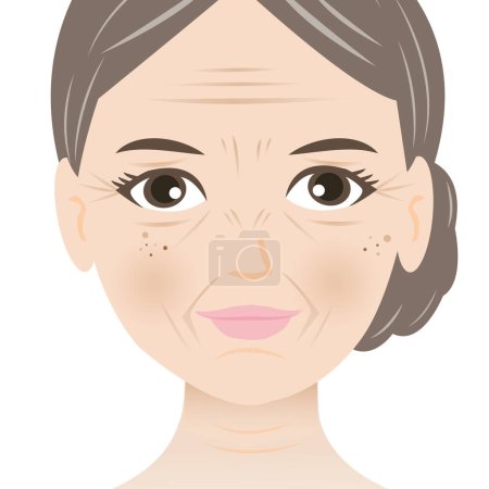 Illustration for Facial wrinkles woman vector illustration isolated on white background. Forehead, Bunny, Marionette, Frown lines, Mental crease, Crows feet, Tear troughs, Nasolabial folds, Smile and Neck lines. - Royalty Free Image