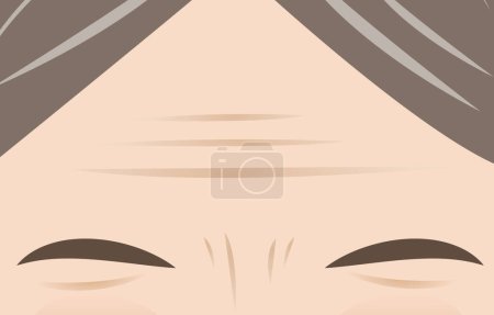 Illustration for Forehead and Frown lines on face of mature woman vector illustration. The deep aging wrinkles on upper face, Forehead lines and Frown lines. Skin problem concept. - Royalty Free Image
