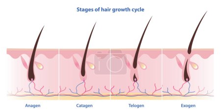 Stages of hair growth cycle vector illustration isolated on white background. Hair grows in four distinct stages. Anagen, growing phase. Catagen, transition phase. Telogen, resting phase. Exogen, shedding phase.