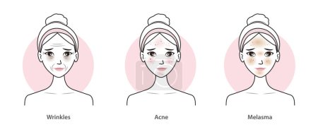 Illustration for Infographic of skin problems set vector illustration isolated on white background. Cute women with wrinkles, aging, dark circles, acne, scar, melasma, hyperpigmentation and dark spots on faces. Skin care and beauty concept. - Royalty Free Image
