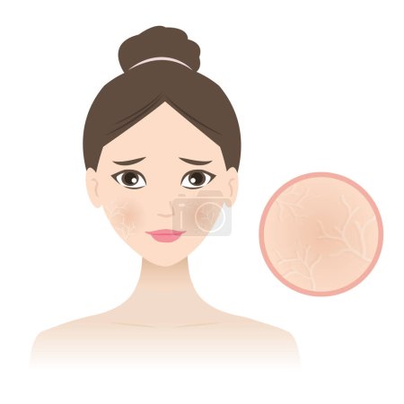 Woman with dehydrated skin face vector illustration isolated on white background. Dry skin patches, rough, scaly and itchy. Fine lines in the skin or a dull complexion. Skin care and beauty concept.