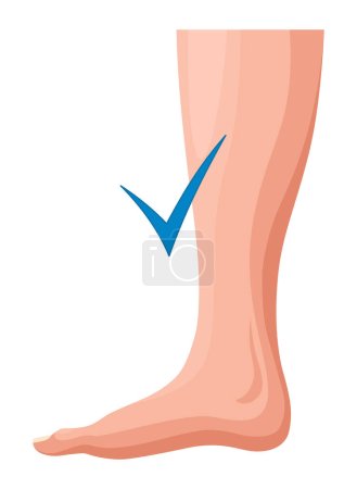 Stages or types of varicose veins development. Medical poster or disease infographic. Image of healthy legs. Vector illustration in flat style.