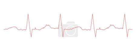 Téléchargez les illustrations : Modèle d'électrocardiogramme. Diagramme du rythme cardiaque. Carte ECG isolée sur fond blanc. Rythme cardiaque ligne rouge. Signe d'examen cardio. Symbole de l'hôpital. Illustration graphique vectorielle - en licence libre de droit