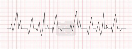 Téléchargez les illustrations : Diagramme de battement de coeur noir sur papier graphique rouge. Ligne d'électrocardiogramme. Rythme cardiaque ou signe cardio-vasculaire. Symbole de l'hôpital. Illustration graphique vectorielle - en licence libre de droit