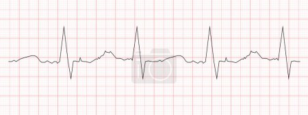 Photo for Black heart beat diagram printed on red graph paper. ECG chart. Cardiac rhythm line. Cardio test sign. Cardiology hospital symbol. Vector graphic illustration - Royalty Free Image