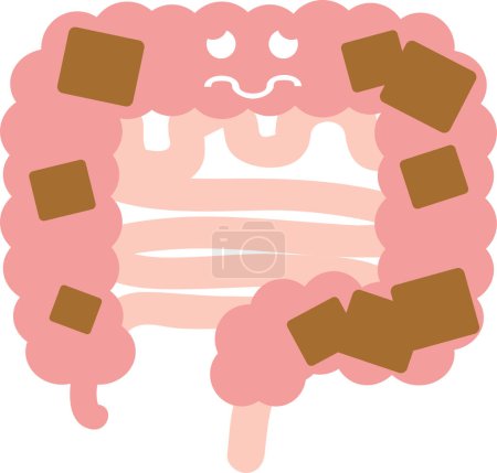 Ilustración de Ilustración de intestinos (estreñimiento) Órganos internos Órganos digestivos - Imagen libre de derechos