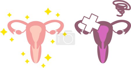 Illustration for Illustration of simple healthy uterus Viscera / Reproductive organs - Royalty Free Image