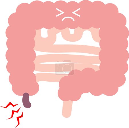 Téléchargez les illustrations : Clip art de l'appendicite (appendice) Organes internes Organes digestifs - en licence libre de droit