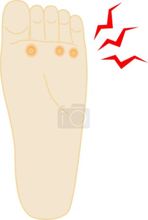Illustration for Clip art of fish eye Ouch foot - Royalty Free Image