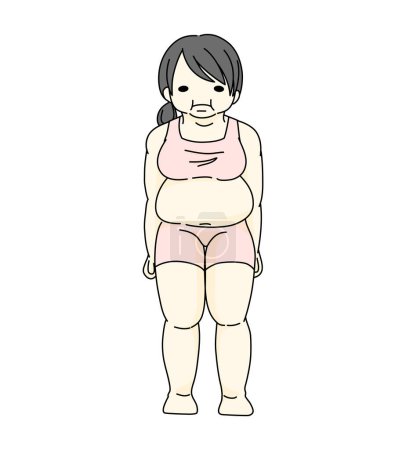 Illustration for Obesity Female deformed body shape Illustration - Royalty Free Image