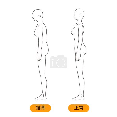 Illustration for Woman medical posture(hunched back) beauty naked nude full body horizontal clip art - Royalty Free Image