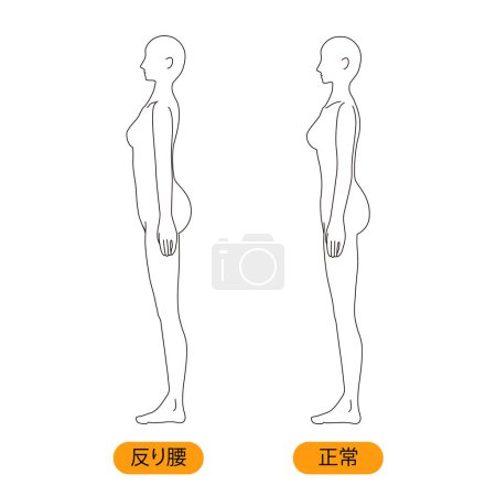 Illustration for Woman medical posture(hunched back) beauty naked nude full body horizontal clip art - Royalty Free Image