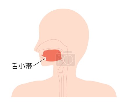 Illustration for Medical illustration depicting the lingual pedicel - Royalty Free Image