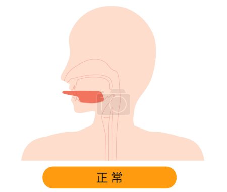 Illustration for Illustration of a free tongue with a broken tongue strip - Royalty Free Image