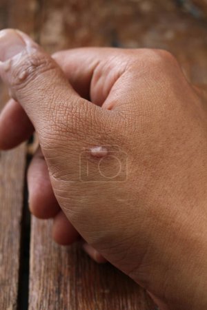 Téléchargez les photos : Homme avec peau sur la main - en image libre de droit