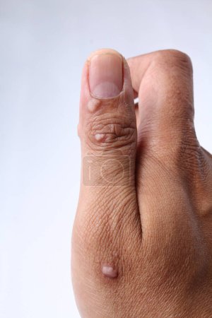 Téléchargez les photos : Gros plan du doigt de l'homme sur la peau - en image libre de droit