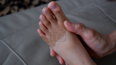 Foto de Vitiligo on a little kid foot, close-up view - Imagen libre de derechos