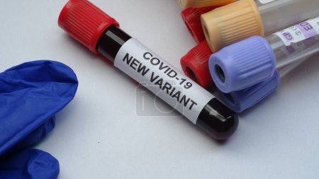 Foto de Tubo sanguíneo de Covid-19, nueva variante del virus Corona - Imagen libre de derechos