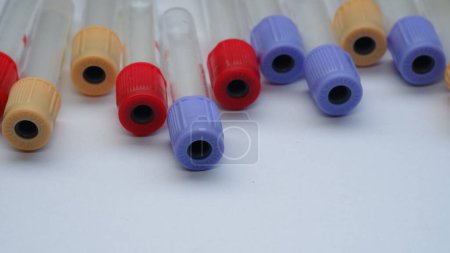 Téléchargez les photos : Test du tube sanguin vide en multicolore. - en image libre de droit