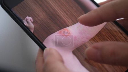 A man is looking for information online about skin diseases on smartphones.