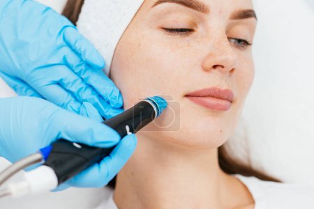 Photo for Face Skin Care. Close-up Of Woman Getting Facial Hydro Microdermabrasion Peeling Treatment At Cosmetic Beauty Spa Clinic. Hydra Vacuum Cleaner. Exfoliation, Rejuvenation And Hydratation. Cosmetology. - Royalty Free Image