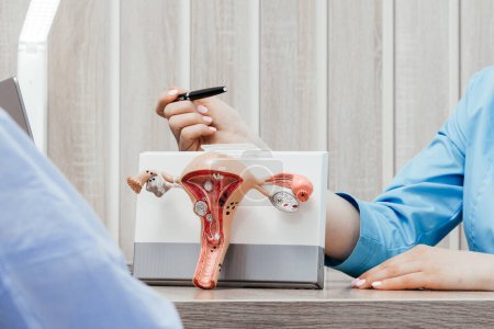 Un médico ginecólogo sostiene un modelo del útero y los ovarios. Cáncer de ovario y cuello uterino, trastorno cervical, endometriosis, histerectomía, fibromas uterinos, sistema reproductivo y concepto de embarazo.