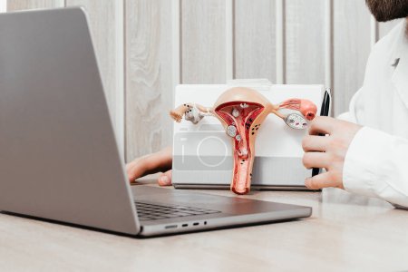 Un médico ginecólogo sostiene un modelo del útero y los ovarios. Cáncer de ovario y cuello uterino, trastorno cervical, endometriosis, histerectomía, fibromas uterinos, sistema reproductivo y concepto de embarazo.