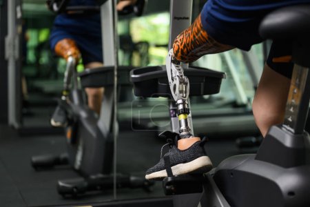 Photo for Disabled athlete patient with prosthetic leg doing exercise at gym, People with physical disability, High tech technology at prosthetic health care center, New artificial limb for disabled people - Royalty Free Image