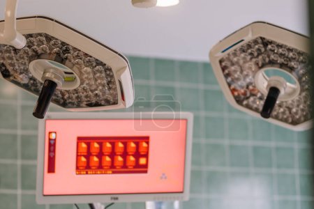 Valmiera, Latvia - March 20, 2024 - Overhead surgical lights and a monitor display in an operating room, indicative of an ongoing medical procedure.