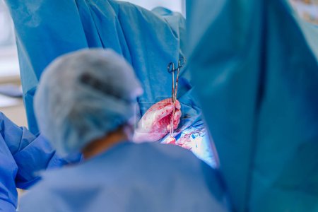 Valmiera, Latvia - March 20, 2024 - Surgeons performing surgery, with bloodied instruments and hands, in a bright operating room.