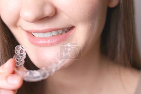 Aligner zum Ausrichten der Zähne 