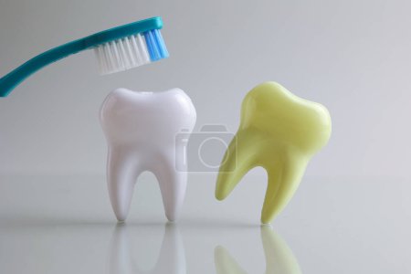 Foto de Concepto odontológico. Modelo de un diente e instrumentos dentales sobre un fondo claro con espacio para texto. .. Foto de alta calidad - Imagen libre de derechos