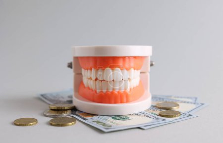 Téléchargez les photos : Modèle dentaire de dents et d'argent. Le prix des services dentaires. . Photo de haute qualité - en image libre de droit