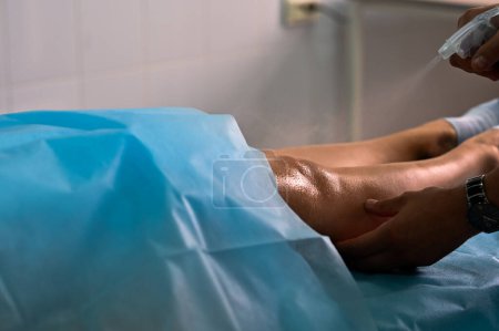 Arzt behandelt Patienten Bein mit Antiseptikum. Hochwertiges Foto