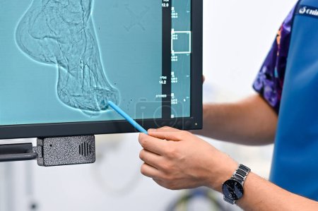 Der Arzt sucht nach einem Röntgenbild von Blutgefäßen und Nerven am Bein. Hochwertiges Foto